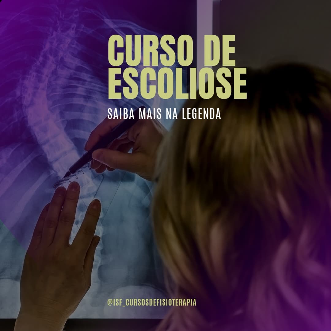Abordagem Fisioterapêutica em Escoliose